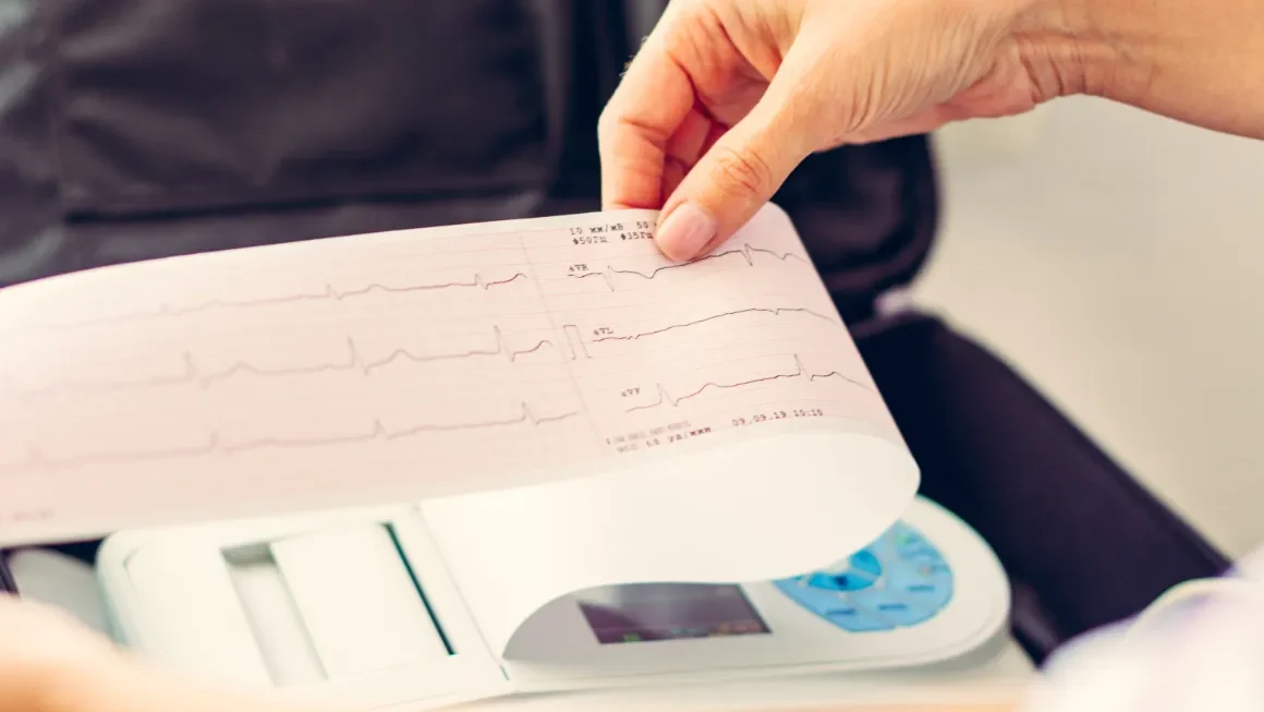 Abnormal ECG